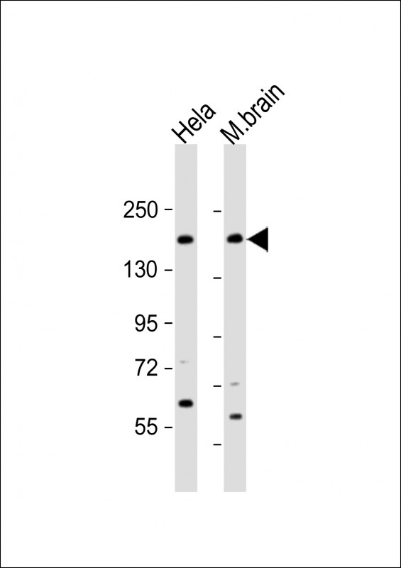 NISCH Antibody - All lanes: Anti-NISCH Antibody (N-Term) at 1:2000 dilution Lane 1: Hela whole cell lysate Lane 2: mouse brain lysate Lysates/proteins at 20 µg per lane. Secondary Goat Anti-Rabbit IgG, (H+L), Peroxidase conjugated at 1/10000 dilution. Predicted band size: 167 kDa Blocking/Dilution buffer: 5% NFDM/TBST.