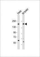 NISCH Antibody - All lanes: Anti-NISCH Antibody (N-Term) at 1:2000 dilution Lane 1: Hela whole cell lysate Lane 2: mouse brain lysate Lysates/proteins at 20 µg per lane. Secondary Goat Anti-Rabbit IgG, (H+L), Peroxidase conjugated at 1/10000 dilution. Predicted band size: 167 kDa Blocking/Dilution buffer: 5% NFDM/TBST.