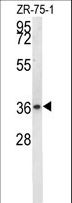 NIT1 Antibody - NIT1 Antibody western blot of ZR-75-1 cell line lysates (35 ug/lane). The NIT1 antibody detected the NIT1 protein (arrow).