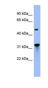 NIT1 Antibody - NIT1 antibody Western blot of 293T cell lysate. This image was taken for the unconjugated form of this product. Other forms have not been tested.