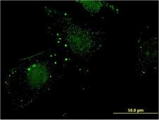 NIT1 Antibody - Immunofluorescence of monoclonal antibody to NIT1 on HeLa cell . [antibody concentration 10 ug/ml]