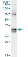 NIT1 Antibody - Immunoprecipitation of NIT1 transfected lysate using anti-NIT1 monoclonal antibody and Protein A Magnetic Bead, and immunoblotted with NIT1 monoclonal antibody.