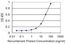 NIT1 Antibody - Detection limit for recombinant GST tagged NIT1 is 1 ng/ml as a capture antibody.