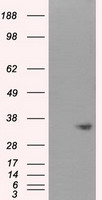 NIT1 Antibody - HEK293T cells were transfected with the pCMV6-ENTRY control (Left lane) or pCMV6-ENTRY NIT1 (Right lane) cDNA for 48 hrs and lysed. Equivalent amounts of cell lysates (5 ug per lane) were separated by SDS-PAGE and immunoblotted with anti-NIT1.
