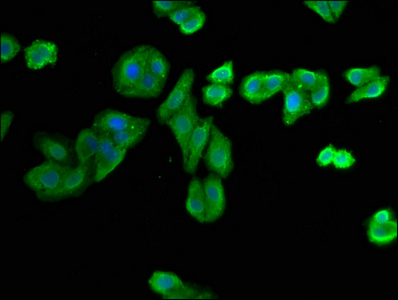NIT1 Antibody - Immunofluorescence staining of HepG2 cells with NIT1 Antibody at 1:400, counter-stained with DAPI. The cells were fixed in 4% formaldehyde, permeabilized using 0.2% Triton X-100 and blocked in 10% normal Goat Serum. The cells were then incubated with the antibody overnight at 4°C. The secondary antibody was Alexa Fluor 488-congugated AffiniPure Goat Anti-Rabbit IgG(H+L).