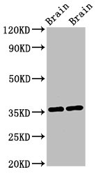 NIT1 Antibody - Western Blot Positive WB detected in: Mouse brain tissue, Rat brain tissue All lanes: NIT1 antibody at 3µg/ml Secondary Goat polyclonal to rabbit IgG at 1/50000 dilution Predicted band size: 36, 32, 41, 35, 27 kDa Observed band size: 36 kDa