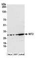 NIT2 Antibody - Detection of human NIT2 by western blot. Samples: Whole cell lysate (15 µg) from HeLa, HEK293T, and Jurkat cells prepared using NETN lysis buffer. Antibody: Affinity purified rabbit anti-NIT2 antibody used for WB at 1:1000. Detection: Chemiluminescence with an exposure time of 3 minutes.