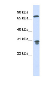NIT2 Antibody - NIT2 antibody western blot of Human Fetal Liver lysate.  This image was taken for the unconjugated form of this product. Other forms have not been tested.