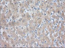 NIT2 Antibody - IHC of paraffin-embedded Human liver tissue using anti-NIT2 mouse monoclonal antibody. (Dilution 1:50).