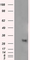 NIT2 Antibody - HEK293T cells were transfected with the pCMV6-ENTRY control (Left lane) or pCMV6-ENTRY NIT2 (Right lane) cDNA for 48 hrs and lysed. Equivalent amounts of cell lysates (5 ug per lane) were separated by SDS-PAGE and immunoblotted with anti-NIT2.