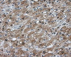 NIT2 Antibody - Immunohistochemical staining of paraffin-embedded liver tissue using anti-NIT2 mouse monoclonal antibody. (Dilution 1:50).