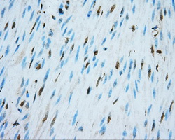 NIT2 Antibody - IHC of paraffin-embedded colon tissue using anti-NIT2 mouse monoclonal antibody. (Dilution 1:50).