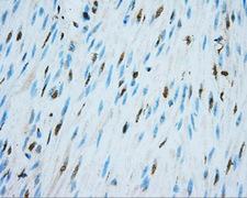 NIT2 Antibody - IHC of paraffin-embedded colon tissue using anti-NIT2 mouse monoclonal antibody. (Dilution 1:50).