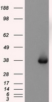 NIT2 Antibody - HEK293T cells were transfected with the pCMV6-ENTRY control (Left lane) or pCMV6-ENTRY NIT2 (Right lane) cDNA for 48 hrs and lysed. Equivalent amounts of cell lysates (5 ug per lane) were separated by SDS-PAGE and immunoblotted with anti-NIT2.