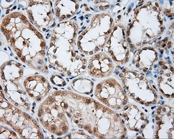 NIT2 Antibody - IHC of paraffin-embedded Kidney tissue using anti-NIT2 mouse monoclonal antibody. (Dilution 1:50).