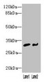 NIT2 Antibody - Western blot All lanes: NIT2 antibody at 3µg/ml Lane 1: Mouse heart tissue Lane 2: A549 whole cell lysate Secondary Goat polyclonal to rabbit IgG at 1/10000 dilution Predicted band size: 31 kDa Observed band size: 31 kDa