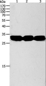 NIT2 Antibody - Western blot analysis of Mouse liver and kidney tissue, RAW264.7 cell, using NIT2 Polyclonal Antibody at dilution of 1:950.