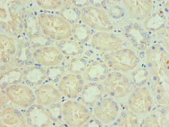 NIX / BNIP3L Antibody - Immunohistochemistry of paraffin-embedded human kidney using antibody at 1:100 dilution.