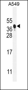 NIX / BNIP3L Antibody - NIX Antibody western blot of A549 cell line lysates (35 ug/lane). The NIX antibody detected the NIX protein (arrow).