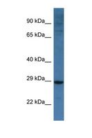 NIX / BNIP3L Antibody - BNIP3L antibody Western blot of Mouse Spleen lysate. Antibody concentration 1 ug/ml.  This image was taken for the unconjugated form of this product. Other forms have not been tested.