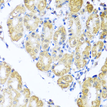 NIX / BNIP3L Antibody - Immunohistochemistry of paraffin-embedded human stomach tissue.