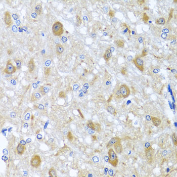NIX / BNIP3L Antibody - Immunohistochemistry of paraffin-embedded rat brain tissue.