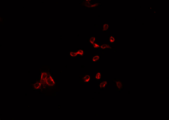 NIX / BNIP3L Antibody - Staining HepG2 cells by IF/ICC. The samples were fixed with PFA and permeabilized in 0.1% Triton X-100, then blocked in 10% serum for 45 min at 25°C. The primary antibody was diluted at 1:200 and incubated with the sample for 1 hour at 37°C. An Alexa Fluor 594 conjugated goat anti-rabbit IgG (H+L) antibody, diluted at 1/600, was used as secondary antibody.