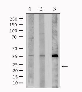 NIX / BNIP3L Antibody - Western blot analysis of extracts of various samples using BNIP3L antibody. Lane 1: rat brain; Lane 2: mouse brain; Lane 3: HeLa;