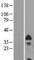 NIX / BNIP3L Protein - Western validation with an anti-DDK antibody * L: Control HEK293 lysate R: Over-expression lysate
