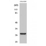 NK1 / CD160 Antibody - Western blot of CD160 antibody
