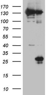 NK1 / CD160 Antibody - HEK293T cells were transfected with the pCMV6-ENTRY control. (Left lane) or pCMV6-ENTRY CD160. (Right lane) cDNA for 48 hrs and lysed. Equivalent amounts of cell lysates. (5 ug per lane) were separated by SDS-PAGE and immunoblotted with anti-CD160. (1:2000)