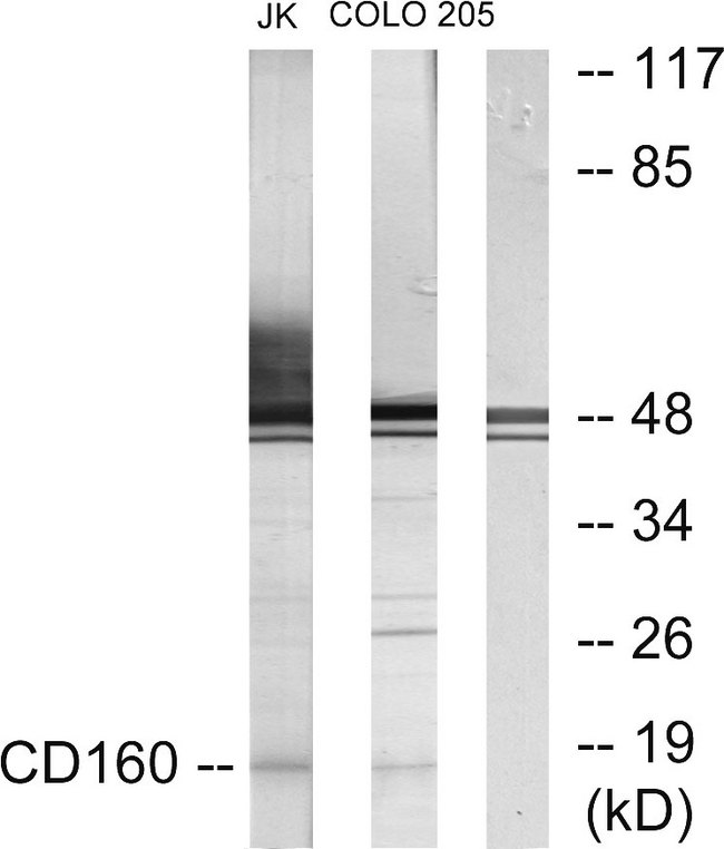 NK1 / CD160 Antibody - Western blot analysis of lysates from Jurkat and COLO205 cells, using CD160 Antibody. The lane on the right is blocked with the synthesized peptide.