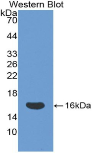 NK1 / CD160 Antibody - Western blot of recombinant NK1 / CD160.  This image was taken for the unconjugated form of this product. Other forms have not been tested.