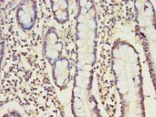 NK1 / CD160 Antibody - Immunohistochemistry of paraffin-embedded human small intestine using antibody at 1:100 dilution.  This image was taken for the unconjugated form of this product. Other forms have not been tested.