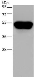 NK1 / CD160 Antibody - Western blot analysis of HeLa cell, using CD160 Polyclonal Antibody at dilution of 1:250.