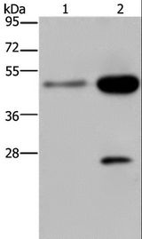 NK1 / CD160 Antibody - Western blot analysis of 231 and HeLa cell, using CD160 Polyclonal Antibody at dilution of 1:300.