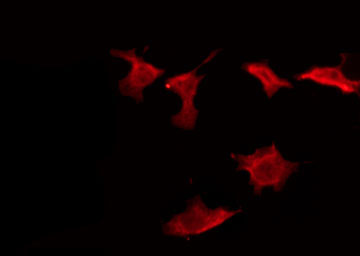 NK1 / CD160 Antibody - Staining HeLa cells by IF/ICC. The samples were fixed with PFA and permeabilized in 0.1% Triton X-100, then blocked in 10% serum for 45 min at 25°C. The primary antibody was diluted at 1:200 and incubated with the sample for 1 hour at 37°C. An Alexa Fluor 594 conjugated goat anti-rabbit IgG (H+L) Ab, diluted at 1/600, was used as the secondary antibody.