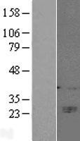 NK1 / CD160 Protein - Western validation with an anti-DDK antibody * L: Control HEK293 lysate R: Over-expression lysate