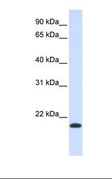 NKAIN1 Antibody - Fetal muscle lysate. Antibody concentration: 1.0 ug/ml. Gel concentration: 12%.  This image was taken for the unconjugated form of this product. Other forms have not been tested.