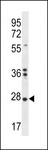 NKAIN1 Antibody - NKAIN1 Antibody western blot of K562 cell line lysates (35 ug/lane). The NKAIN1 antibody detected the NKAIN1 protein (arrow).