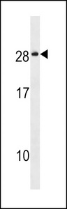 NKAIN4 / C20orf58 Antibody - NKAI4 Antibody western blot of MCF-7 cell line lysates (35 ug/lane). The NKAI4 antibody detected the NKAI4 protein (arrow).