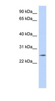 NKAIN4 / C20orf58 Antibody - NKAIN4 antibody Western blot of MCF7 cell lysate. This image was taken for the unconjugated form of this product. Other forms have not been tested.