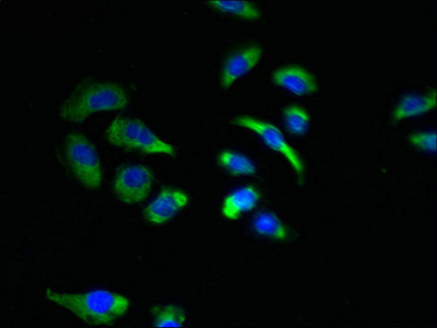 NKAIN4 / C20orf58 Antibody - Immunofluorescent analysis of A549 cells using NKAIN4 Antibody at dilution of 1:100 and Alexa Fluor 488-congugated AffiniPure Goat Anti-Rabbit IgG(H+L)
