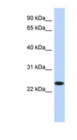 NKAIN4 / C20orf58 Antibody - NKAIN4 antibody Western blot of HepG2 cell lysate. This image was taken for the unconjugated form of this product. Other forms have not been tested.