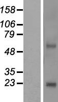 NKAIN4 / C20orf58 Protein - Western validation with an anti-DDK antibody * L: Control HEK293 lysate R: Over-expression lysate