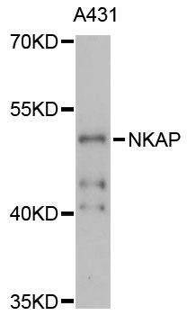 NKAP Antibody - Western blot analysis of extracts of A-431 cells, using NKAP antibody at 1:3000 dilution. The secondary antibody used was an HRP Goat Anti-Rabbit IgG (H+L) at 1:10000 dilution. Lysates were loaded 25ug per lane and 3% nonfat dry milk in TBST was used for blocking. An ECL Kit was used for detection and the exposure time was 90s.