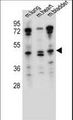 NKD1 Antibody - NKD1 Antibody western blot of mouse lung,heart,bladder tissue lysates (35 ug/lane). The NKD1 antibody detected the NKD1 protein (arrow).