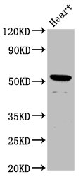 NKD1 Antibody - Positive Western Blot detected in Rat heart tissue. All lanes: NKD1 antibody at 1.8 µg/ml Secondary Goat polyclonal to rabbit IgG at 1/50000 dilution. Predicted band size: 53 KDa. Observed band size: 53 KDa