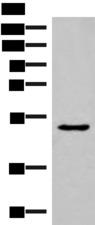 NKD2 Antibody - Western blot analysis of Mouse Pancreas tissue lysate  using NKD2 Polyclonal Antibody at dilution of 1:350