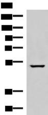 NKD2 Antibody - Western blot analysis of A549 cell lysate  using NKD2 Polyclonal Antibody at dilution of 1:600